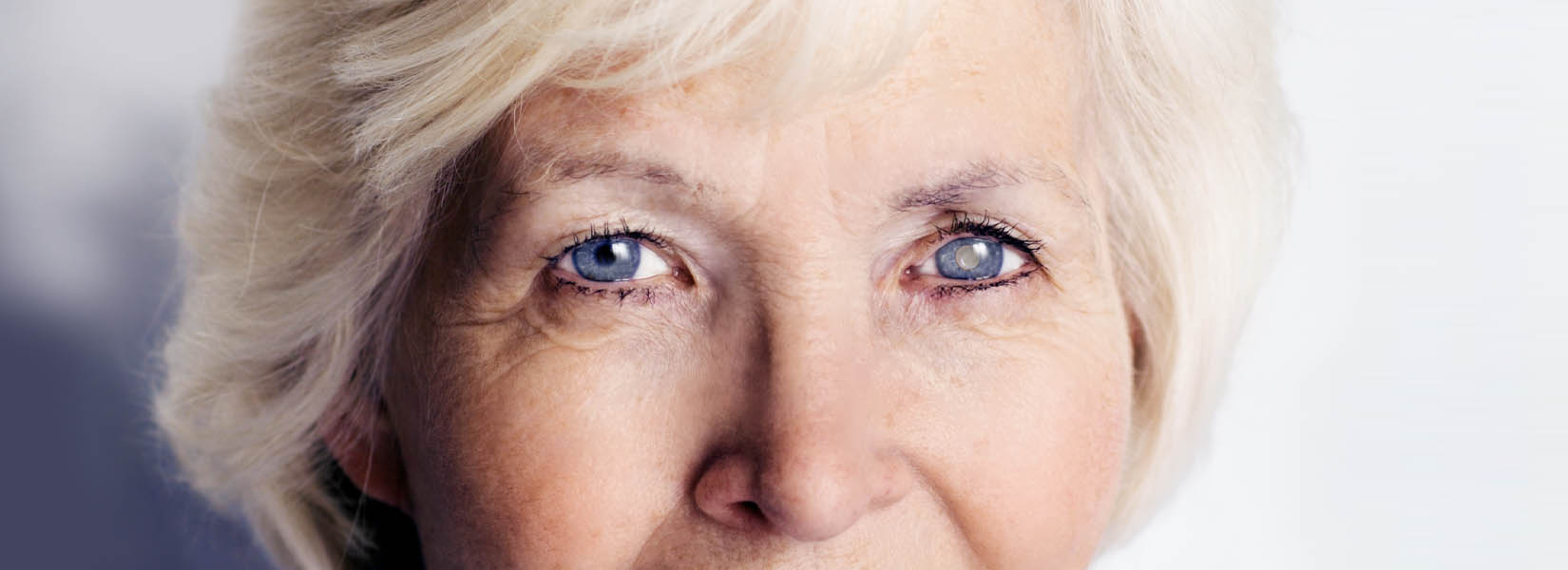Cataract Surgery in Atascocita